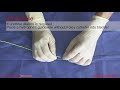 core videos 2019 simple guidewire and angiocatheter technique for difficult urethral catheter