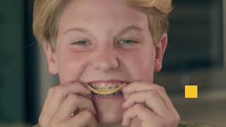 Braces - Part One: Instructions & Tips