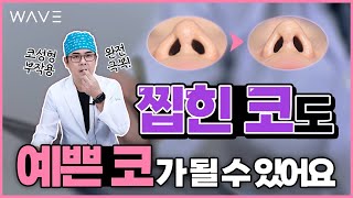 [웨이브의원] 코성형 부작용 때문에 속상하다면ㅠㅠ 찝힌 코에서 예쁜 코가 되어보세요❗