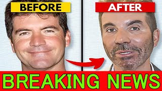 EXCLUSIVE: Simon Cowell's Fresh Plastic Surgery Shocker — Mogul's Pals Beg Him to Quit His '