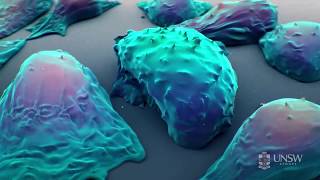 Nanoparticle-based drug delivery in the fight against cancer