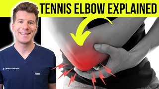 Doctor explains TENNIS ELBOW (lateral epicondylitis) | Symptoms, causes, & treatment