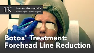 Botox Treatment for Forehead Line Reduction | Dr. Hooman Khorasani