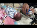 malnutrition crisis hits half of newborns in northern gaza hospital