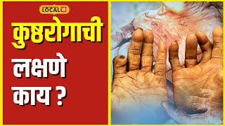 Leprosy कुष्ठरोग दैवी शाप नाही, ही लक्षणे असतील तर त्वरीत डॉक्टरांना दाखवा #local18