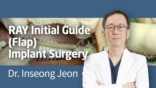 RAY Initial Guide (Flap) Implant Surgery_by Dr. Inseong Jeon