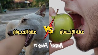 أيهما أخطر ؟! عضة الإنـسان أم الحـيوااان ؟؟! 😨😱😨😱