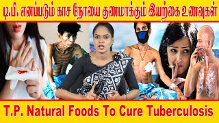 டி பி  எனப்படும் காச நோயை குணமாக்கும் இயற்கை உணவுகள் | T.P. Natural Foods To Cure Tuberculosis