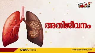 ശ്വാസകോശ അര്‍ബുദം; ഡോ.പ്രശാന്ത് പരമേശ്വന്‍ സംസാരിക്കുന്നു  | അതിജീവനം | Athijeevanam | 24 News