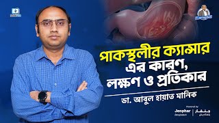 পাকস্থলীর ক্যান্সার এর কারণ #stomachcancer