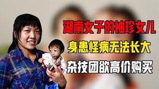 湖南女子的“袖珍女儿”，身患怪病无法长大，杂技团欲高价购买