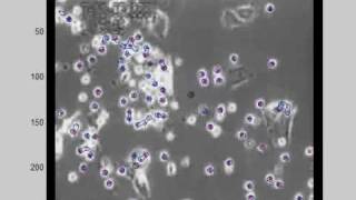 Multi-target tracking of cells using the GMPHD filter