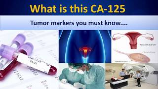 What is this CA -125#CA125#Biochemistrytests#MLS#Cancertests