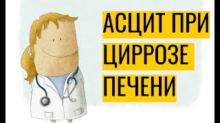 Асцит при циррозе печени: почему возникает и как лечить