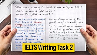 The Only IELTS Writing Task 2 Strategy You Need in 2025