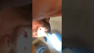 Removing Wires After Jaw Wired Shut