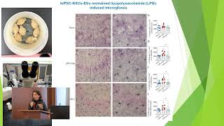 Prof. Dr. Gunel Ayyubova - Therapeutic importance of exosomes in neurological diseases