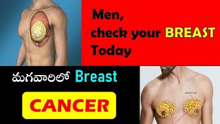 How to self examine Breast in Men /  మగవారిలో రొమ్ము క్యాన్సర్ / Male Breast cancer/ Dr.M.Haindavi