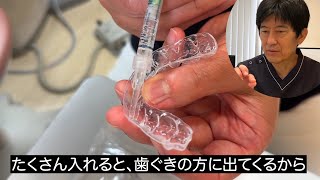 【ホームホワイトニング】自宅で行うホワイトニングについて解説します。