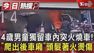 4歲男童獨留車內突火燒車! 「爬出後車廂」頭髮著火燙傷｜TVBS新聞 @TVBSNEWS01