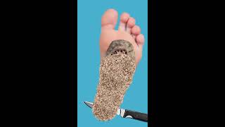 ASMR Animation trick infected foot #asmr #animation #live