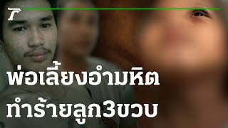 ช่วยเด็กหญิง 3 ขวบถูกพ่อเลี้ยงทำร้าย | 18-02-66 | ข่าวเช้าไทยรัฐ เสาร์-อาทิตย์