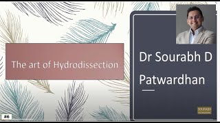 Hydrodissection  Technique and series of cases : Phacoemulsification for beginners