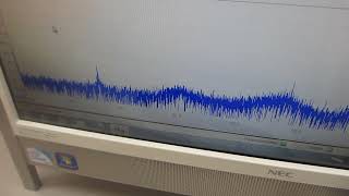 超音波の圧電素子を調整する技術を開発ーー超音波の伝搬特性を測定・解析・評価する技術の応用－－（超音波システム研究所）