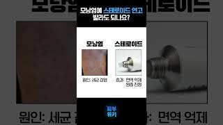 모낭염에 스테로이드 연고를 발라도 된다?