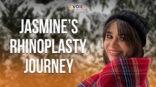 Jasmine had her #rhinoplasty at #Voilahealthtourism - #rhinoplastysurgeon