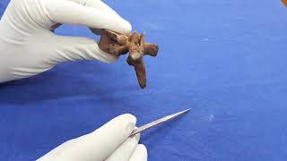 Typical thoracic vertebra - osteology