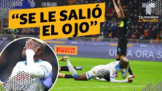 Escalofriante lesión de jugador del Napoli: “se le salió el ojo” | Telemundo Deportes