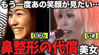 【ガルちゃん芸能】これが整形の代償？鼻が気になる美女たち【ゆっくり解説】