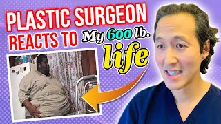 Plastic Surgeon Reacts to MY 600 LB LIFE - One Man's Journey - Dr. Anthony Youn