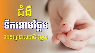 តើជំងឺទឹកនោមផ្អែម អាចព្យាបាល ជាសះស្បើយដែរឬទេ? | Kon Khnhom