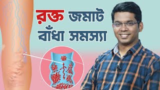 Thrombosis । রক্ত জমাট বাঁধা সমস্যা। Dr. Saklayen Russel