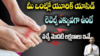 మీ ఒంట్లో యూరిక్ యాసిడ్ లెవెల్స్ ఎక్కువగా ఉంటే వచ్చే మొదటి లక్షణాలు ఇవే| Dr.Madhu Babu Health Trends