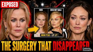 Nicole Kidman's Hidden Face Surgery EXPOSED