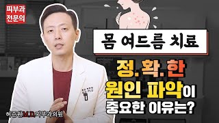 몸여드름 치료, 정확한 원인 파악이 중요한 이유 - 【feat. 피부과전문의】