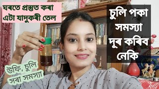 চুলি অকালতে পকিলে কি কৰিব || চুলি সৰা,উফি সমস্যাৰ সমাধান || #home_remedy