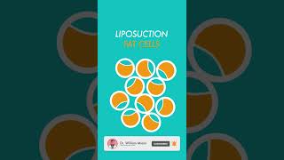 Liposuction vs Weight Loss