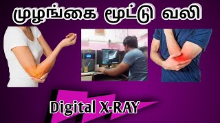 முழங்கை மூட்டு வலி x-ray/ elbow joint X-ray #radiographer #xraytechnician #xray #elbowpain