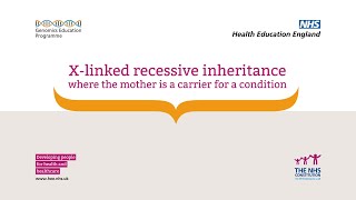 X-linked recessive inheritance - where the mother is a carrier for a condition