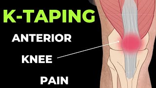 How to apply Kinesiology Taping for Knee Pain - Patella tendonitis and Patella femoral pain