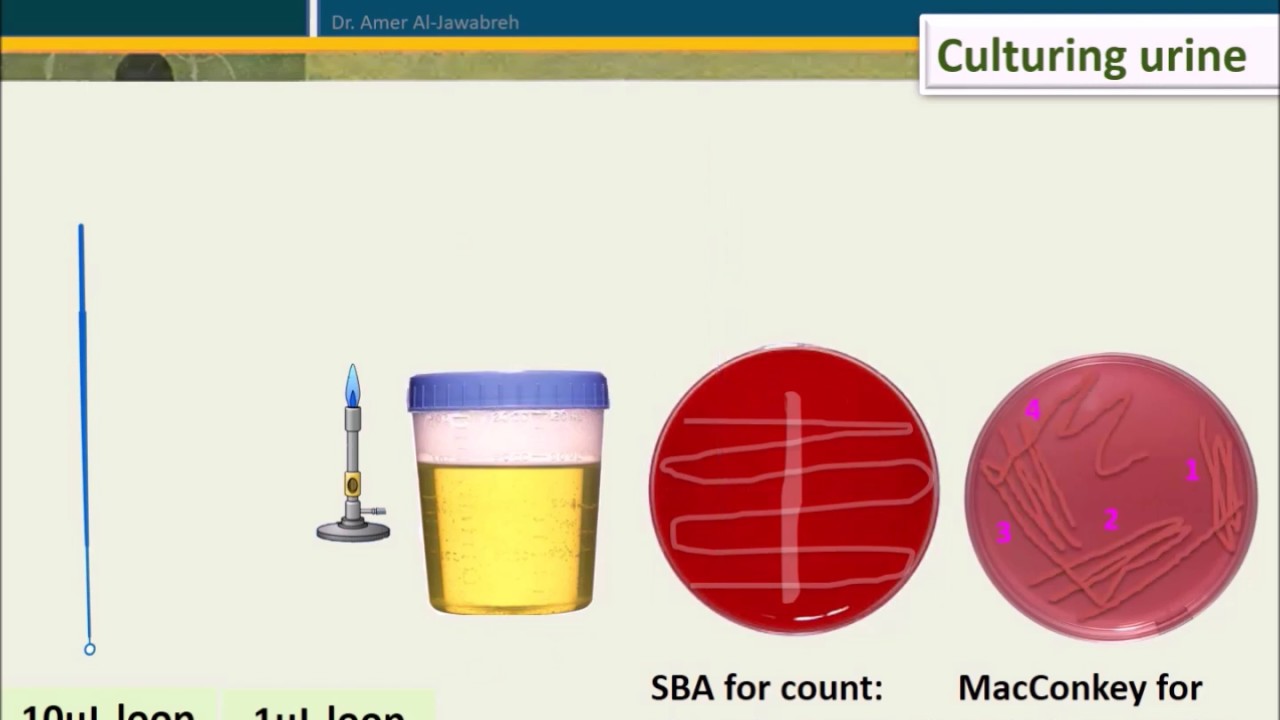 Urine Culture: How To Interpret Count - YouTube