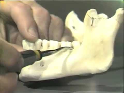 Oral/Maxillofacial Surgery And Dental Anatomy - YouTube