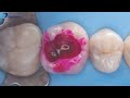 Dr.Carlos Villavicencio introduced and demonstrated Eighteeth 𝐇𝐞𝐥𝐢𝐨𝐬 through this wonderful video.