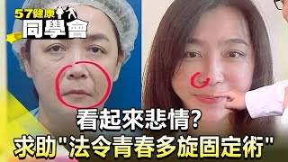 看起來悲情？許聖梅..求助「法令青春多旋固定術」【@57healthy 】2024.10.19｜張予馨、陳峙文、王彥博、莊斯棋、萁媽、許聖梅