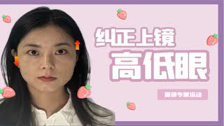 纠正高低眼/高低眉，改善脸歪不上相！3个动作回正面部肌肉，告别拍照不自信