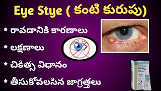 Do's and Don'ts of Eye Stye (కంటి కురుపు) in Telugu